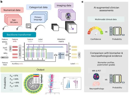 人工智能基礎(chǔ)軟件助力失智癥快速診斷